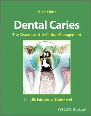 Köp nu - Dental Caries